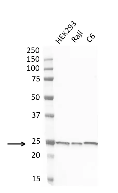 Anti Human Protein Gene Product 9.5 Antibody, clone 31A3 (Monoclonal Antibody Antibody) gallery image 15