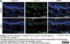 Anti Human Protein Gene Product 9.5 Antibody, clone 31A3 (Monoclonal Antibody Antibody) gallery image 17