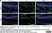 Anti Human Protein Gene Product 9.5 Antibody, clone 31A3 (Monoclonal Antibody Antibody) thumbnail image 17