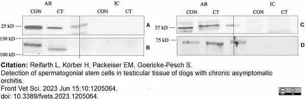 Anti Human Protein Gene Product 9.5 Antibody, clone 31A3 (Monoclonal Antibody Antibody) gallery image 20
