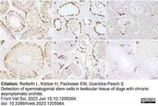 Anti Human Protein Gene Product 9.5 Antibody, clone 31A3 (Monoclonal Antibody Antibody) gallery image 21