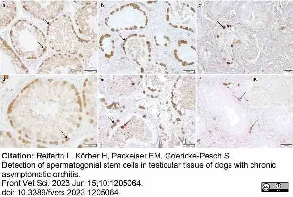 Anti Human Protein Gene Product 9.5 Antibody, clone 31A3 (Monoclonal Antibody Antibody) gallery image 21