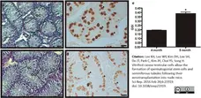 Anti Human Protein Gene Product 9.5 Antibody, clone 31A3 (Monoclonal Antibody Antibody) gallery image 5
