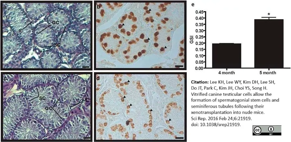 Anti Human Protein Gene Product 9.5 Antibody, clone 31A3 (Monoclonal Antibody Antibody) gallery image 5