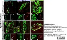 Anti Human Protein Gene Product 9.5 Antibody, clone 31A3 (Monoclonal Antibody Antibody) gallery image 8