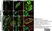 Anti Human Protein Gene Product 9.5 Antibody, clone 31A3 (Monoclonal Antibody Antibody) thumbnail image 8