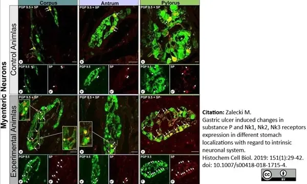 Anti Human Protein Gene Product 9.5 Antibody, clone 31A3 (Monoclonal Antibody Antibody) gallery image 8