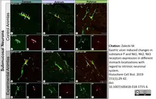 Anti Human Protein Gene Product 9.5 Antibody, clone 31A3 (Monoclonal Antibody Antibody) gallery image 9