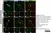 Anti Human Protein Gene Product 9.5 Antibody, clone 31A3 (Monoclonal Antibody Antibody) thumbnail image 9