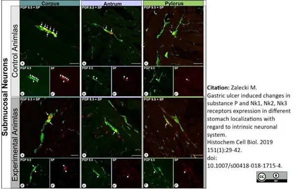 Anti Human Protein Gene Product 9.5 Antibody, clone 31A3 (Monoclonal Antibody Antibody) gallery image 9