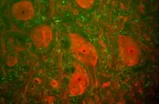 Anti Human Protein Gene Product 9.5 Antibody, clone BH7 gallery image 1
