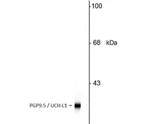 Anti Human Protein Gene Product 9.5 Antibody, clone BH7 gallery image 2