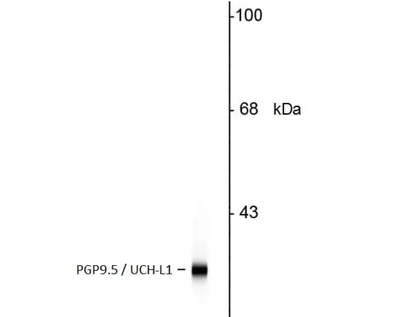 Anti Human Protein Gene Product 9.5 Antibody, clone BH7 gallery image 2