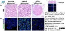 Anti Human Protein Gene Product 9.5 Antibody, clone BH7 gallery image 3