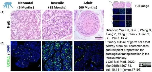 Anti Human Protein Gene Product 9.5 Antibody, clone BH7 gallery image 3