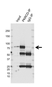 Anti Protein Kinase C Delta Antibody, clone E-J01/1C2 (PrecisionAb Monoclonal Antibody) thumbnail image 2