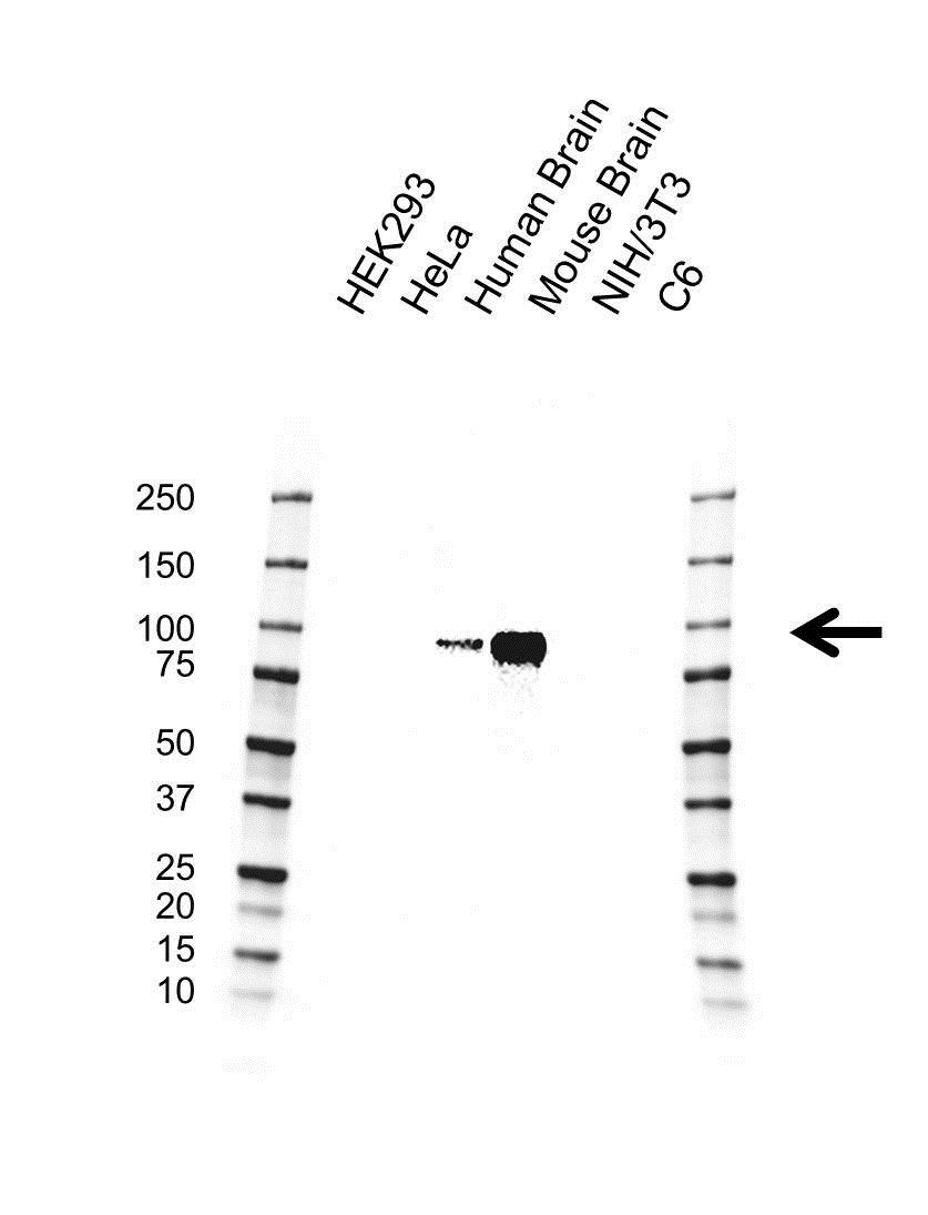 Anti Protein Kinase C Epsilon Antibody, clone CD04/1C7 (PrecisionAb Monoclonal Antibody) gallery image 1
