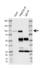 Anti Protein Kinase C Epsilon Antibody, clone CD04/1C7 (PrecisionAb Monoclonal Antibody) thumbnail image 2