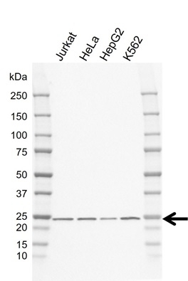 Anti PSMB2 Antibody, clone GH01/3E1 (PrecisionAb Monoclonal Antibody) gallery image 1