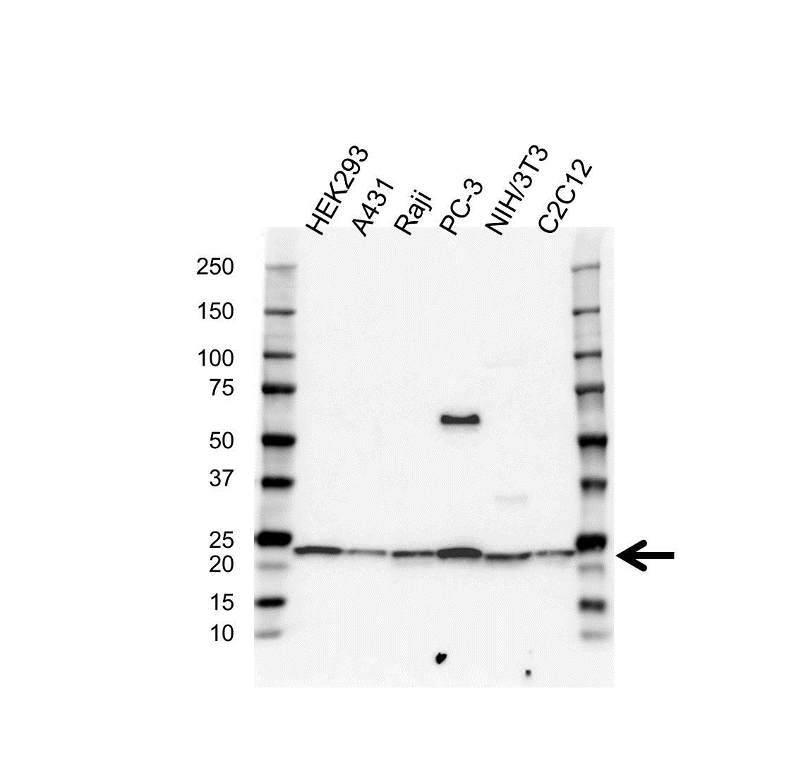 Anti PSMB9 Antibody, clone OTI2B6 (PrecisionAb Monoclonal Antibody) gallery image 1
