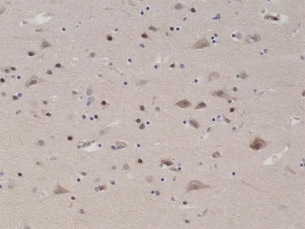 Anti PTEN Tumor Suppressor Protein Antibody, clone RM265 gallery image 3