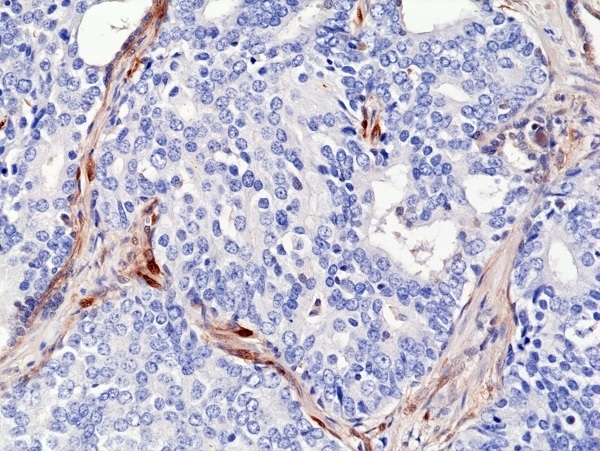 Anti PTEN Tumor Suppressor Protein Antibody, clone RM265 thumbnail image 4