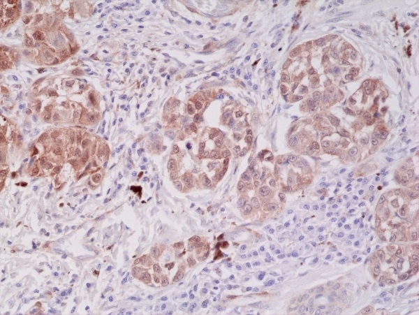 Anti PTEN Tumor Suppressor Protein Antibody, clone RM265 gallery image 5