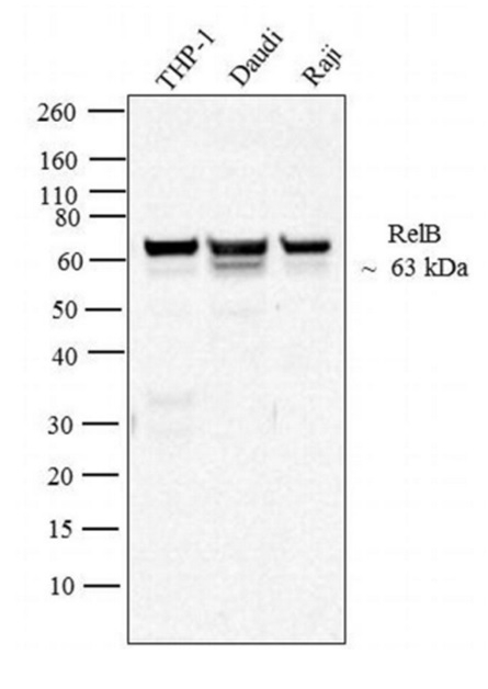 Anti RelB Antibody, clone 17.3 gallery image 1