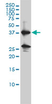 Anti Human Renin Antibody, clone 2H2 thumbnail image 1