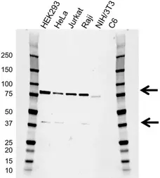 Anti RIPK1 Antibody, clone AB01/3C7 (PrecisionAb Monoclonal Antibody) gallery image 1