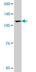 Anti Human ROR1 Antibody, clone 2F8 thumbnail image 1