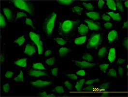 Anti Human RRM2 Antibody, clone 1E1 thumbnail image 2
