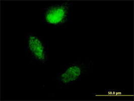 Anti Human S100A4 Antibody, clone 1F12-1G7 gallery image 1