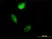 Anti Human S100A4 Antibody, clone 1F12-1G7 thumbnail image 1