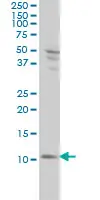 Anti Human S100A4 Antibody, clone 1F12-1G7 gallery image 2