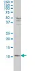 Anti Human S100A4 Antibody, clone 1F12-1G7 thumbnail image 2