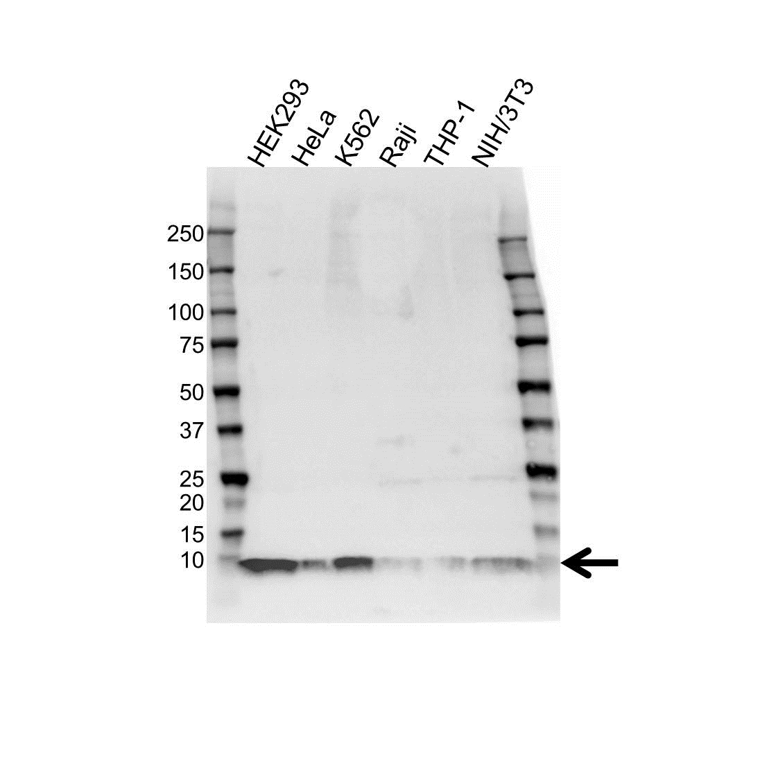 Anti S100A8 Antibody (PrecisionAb Monoclonal Antibody) gallery image 1