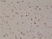 Anti SATB2 Antibody, clone RM365 thumbnail image 2