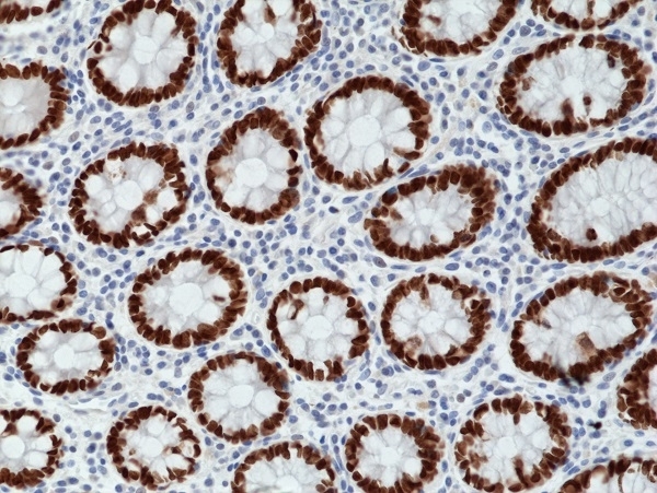 Anti SATB2 Antibody, clone RM365 gallery image 4