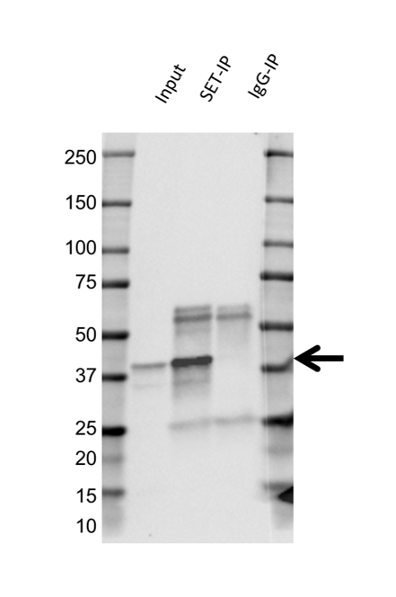 Anti SET Antibody, clone AB02/4F6 (PrecisionAb Monoclonal Antibody) gallery image 2