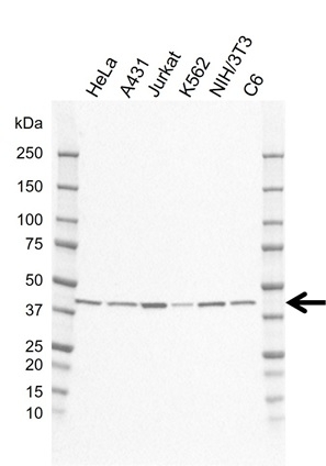 Anti SIRT6 Antibody, clone EF01/2A11 (PrecisionAb Monoclonal Antibody) gallery image 1