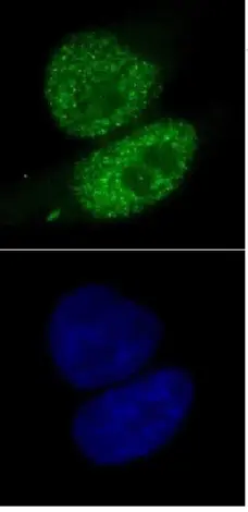 Anti Human SMARCA4 Antibody, clone 5B7 gallery image 1