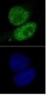 Anti Human SMARCA4 Antibody, clone 5B7 thumbnail image 1