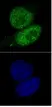 Anti Human SMARCA4 Antibody, clone 5B7 thumbnail image 1