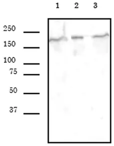 Anti Human SMARCA4 Antibody, clone 5B7 gallery image 2