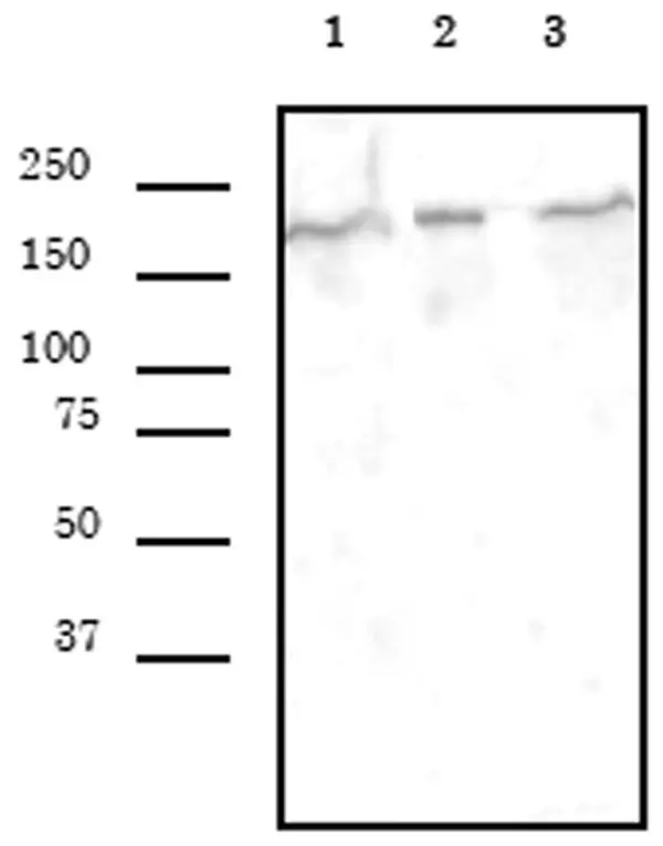 Anti Human SMARCA4 Antibody, clone 5B7 gallery image 2