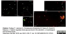 Anti Human Somatostatin Antibody, clone YC7 gallery image 1