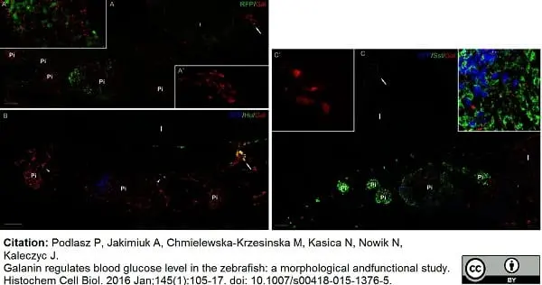 Anti Human Somatostatin Antibody, clone YC7 gallery image 4