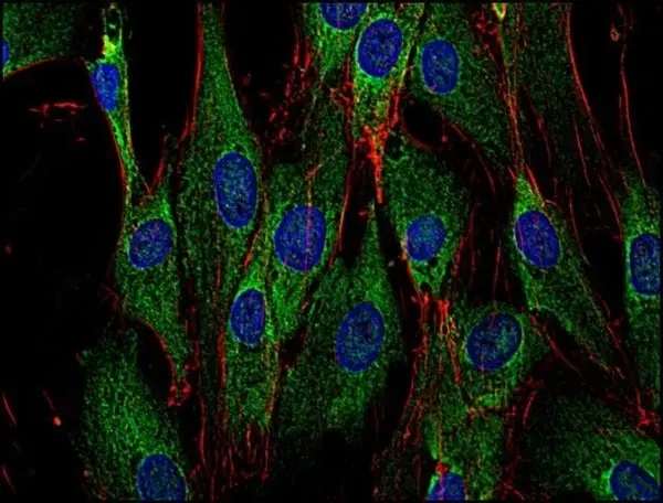 Anti SOS1 Antibody, clone SOS-01 gallery image 2