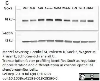 Anti Human SOX9 Antibody, clone 3C10 gallery image 10